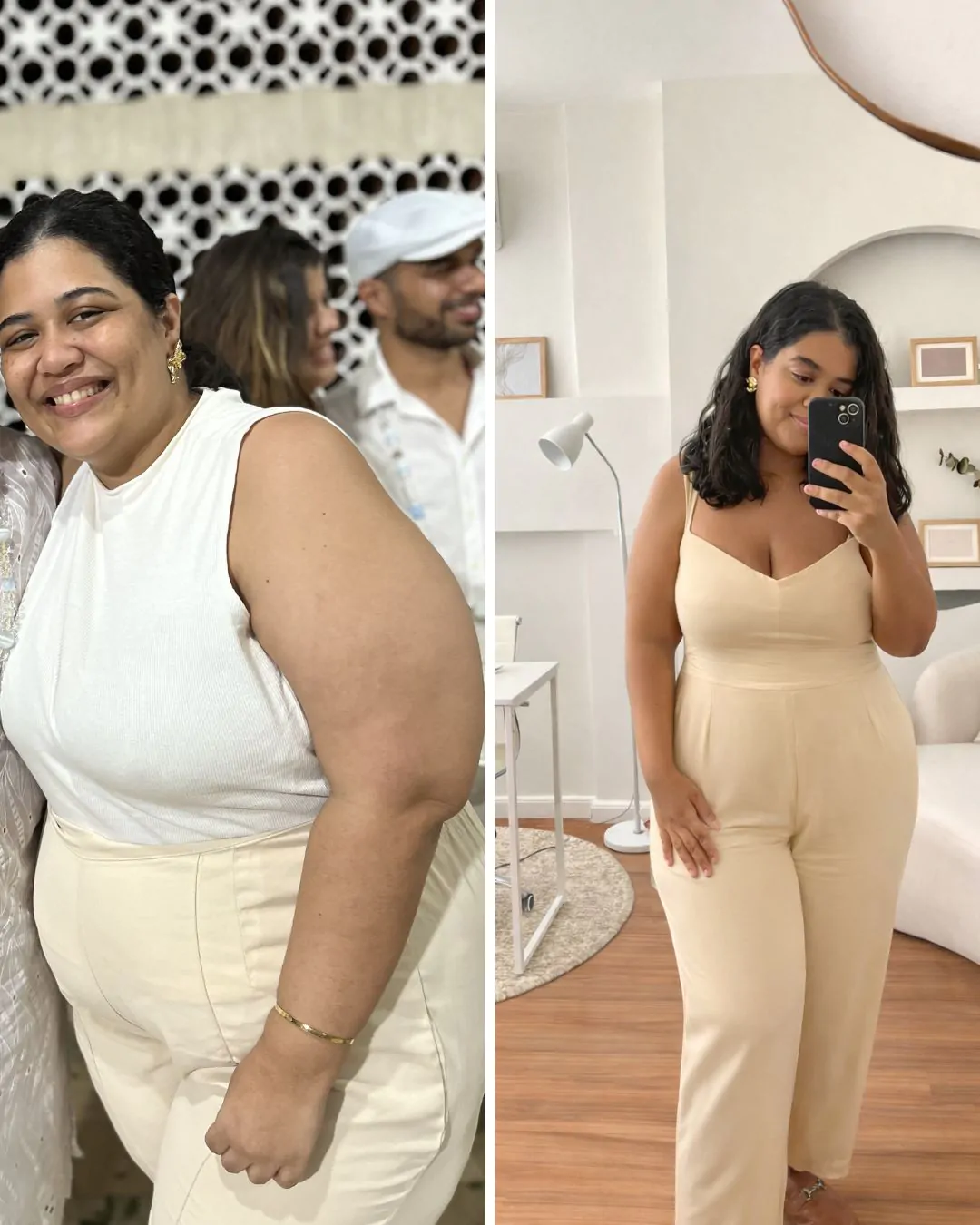 Evolução de Joyce Colpaert — paciente da Dra. Camila Teixeira